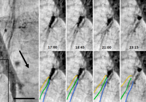 New Microscopic Method for Imaging Live Tumor Cells Behavior