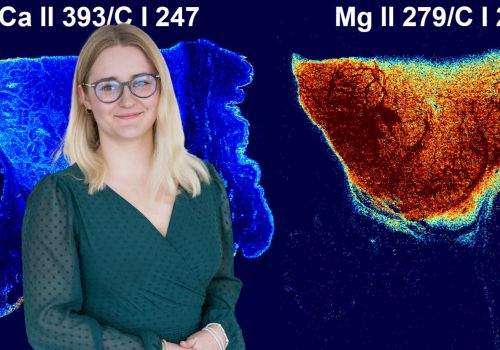Awarded student Hana Kopřivová aims to come up with a new system for diagnosing tumors